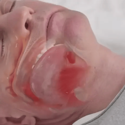 Anti Snore Mouth Piece