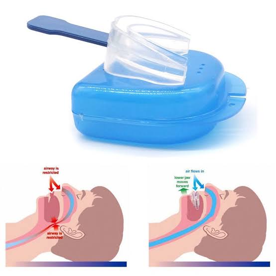 Anti Snore Mouth Piece